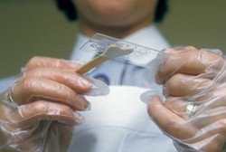 Sudah Vaksin HPV Tetap Perlu Papsmear, Ini Sebabnya