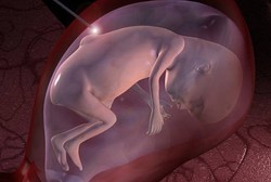 Kelak, Janin dalam Kandungan pun Bisa Dioperasi dengan Robot