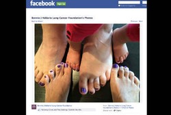 Pamer Kuku Bercat Ungu, Kampanye Melawan Kanker Paru di Amerika