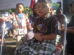 Polda Metro Jaya Gelar Operasi Katarak, Bibir Sumbing dan Sunatan Gratis