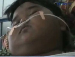 Bocah 12 Tahun Miliki Bobot Tubuh 110 Kilogram