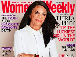 Inspiratif, Wanita dengan Luka Bakar Ini Jadi Model Sampul Majalah