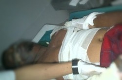 Semangat Bertahan Jadi Faktor untuk Akhiri Masa Kritis Juru Parkir Monas