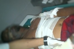 Juru Parkir Liar Monas yang Dibakar Dipindahkan ke RSCM