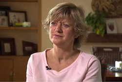 Wanita Ini Akan Jadi Pasien Cangkok Tangan Dobel Pertama di UK