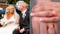 Cincin Pernikahan Dicuri, Pasangan Ini Menggantinya dengan Permen Jelly