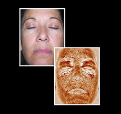 Foto: Begini Penampakan Kulit Wajah Ketika Tidak Pernah Pakai Sunscreen