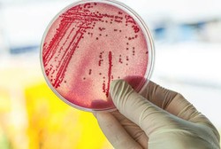 Bahaya Bakteri Super, Inggris Siapkan Penghargaan Berhadiah Rp 200 M