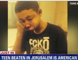 Sepupu ABG Palestina Korban Pembakaran Dipukuli Tentara Israel