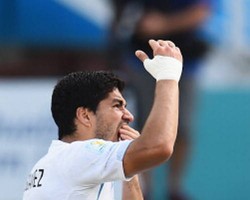 Dihukum FIFA, Suarez Urung Bintangi Iklan Pelindung Gigi