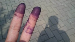 Banyak Warga Celup 2 Jari ke Tinta, KPU: Sebaiknya 1 Saja Biar Tidak Boros