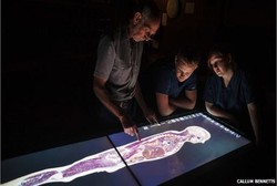 Belajar Anatomi, Mahasiswa Kedokteran di Inggris Dibekali Mayat Virtual