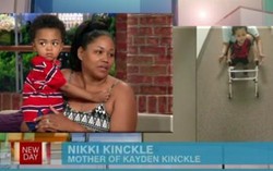 Langkah Pertama Balita 2 Tahun Berkaki Palsu yang Menginspirasi