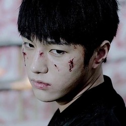 Wajah Luka-luka Infinite di Teaser Video Back