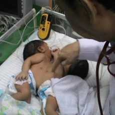 RSU Soetomo Rawat Bayi Kembar Siam Sahrini-Sahrina Asal Jember