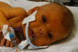 Mengharukan, Ayah Ini Sembuhkan Anaknya dari Tumor Hati dengan Photoshop