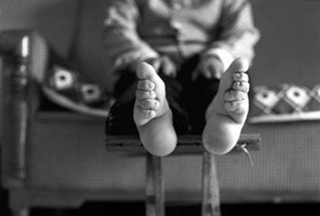 Potret Wanita-wanita China dengan Jari Kaki Menyatu Akibat Foot-Binding