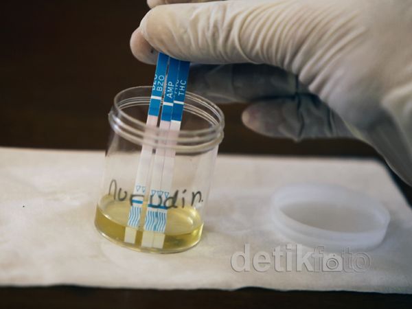 Tes Urine Supir Bus Angkutan Lebaran