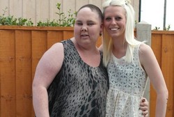 Tumor Otak, Bobot Amy Naik 57 Kg dan Divonis Hidup 6 Bulan Lagi