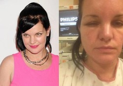 Wajah Membengkak, Bintang Serial NCIS Dilarikan ke RS Pasca Warnai Rambut