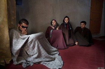 Potret Korban-korban Air Gun, Mata Buta Hingga Peluru Tertanam di Kepala