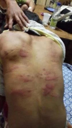 TKW ini Disiksa Majikannya di Saudi dan Kini Butuh Pertolongan