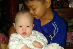 Lahir dengan Keterbelakangan Mental, Bayi Ini Ditinggalkan Orang Tuanya