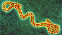 Pasien Kedua Ebola Tiba di AS untuk Mendapat Perawatan Lebih Lanjut