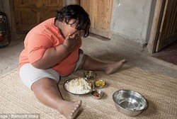 Ya Ampun! Di Usia 9 Tahun Bobot Bocah Ini Mencapai 91 Kg