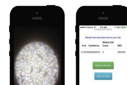 Cukup dengan Memotret Darah, Aplikasi Ini Bisa Tahu Anda Sakit Apa