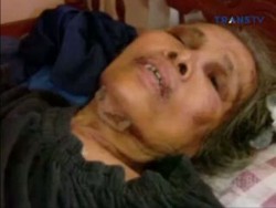 Diduga Akibat Malpraktek, Tubuh Nenek Ini Melepuh Usai Disuntik