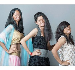 3 Wanita India dengan Luka Bakar Jadi Model Pemotretan Fashion