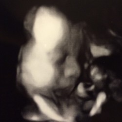 Nikita Mirzani Pamer Foto Anak Kedua