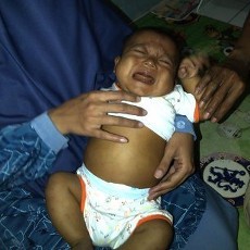 Mengidap Atresia Billier, Bayi di Depok Butuh Rp 900 juta untuk Cangkok Hati