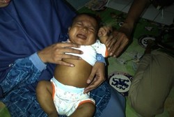 Mengidap Atresia Billier, Bayi di Depok Butuh Rp 900 juta untuk Cangkok Hati