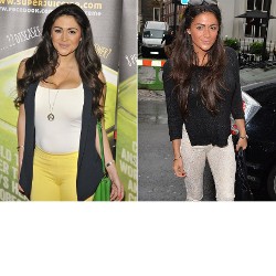 Model Casey Batchelor Jalani Operasi Kecilkan Payudara