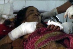 Meski Luka Parah, Wanita Ini Serang Macan Tutul yang Menerkamnya