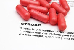 Gejala Stroke Sembuh dalam Waktu 24 Jam? Waspadai Stroke Ringan