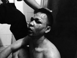 Bak buk! Maling ini Babak Belur Dikeroyok Warga di Kalibata