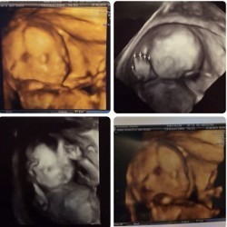 Gisel Hamil Anak Perempuan