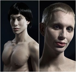 Begini Bentuk Wajah dan Tubuh dengan Hasil Operasi Plastik Ekstrem