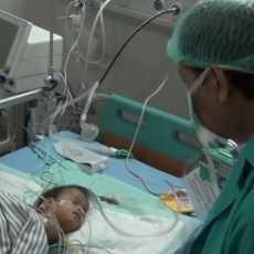 Rahma, Bayi Kembar Siam asal Banyuwangi Meninggal Usai Dioperasi