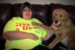 Kelainan Gen Sehingga Tidak Bisa Merasa Kenyang, Remaja 14 Tahun Obesitas