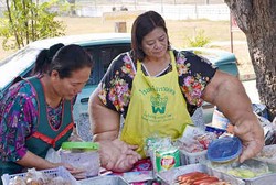 Idap Kelainan Langka, Tangan Wanita Ini Membesar dan Beratnya Capai 9,5 Kg
