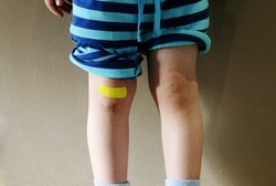 Kecoak Hingga Belatung, Ragam Serangga yang Dijadikan Obat Alternatif