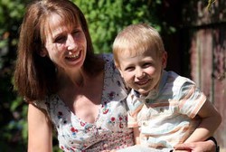 Gara-gara Penyakit Langka, Bocah Ini Bisa Kaku Mendadak Saat Kaget