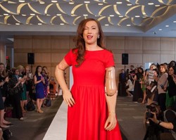 Wanita dengan Tangan Amputasi Jadi Model di New York Fashion Week