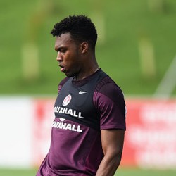 Sturridge Berharap Secepatnya Bisa Main Lagi