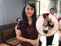 Duh... Tersandung Besi, Jari Tessa Kaunang Sobek 7 Jahitan