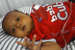 Sakit Atresia Bilier, Bayi Ini Butuh Rp 900 Juta untuk Cangkok Hati